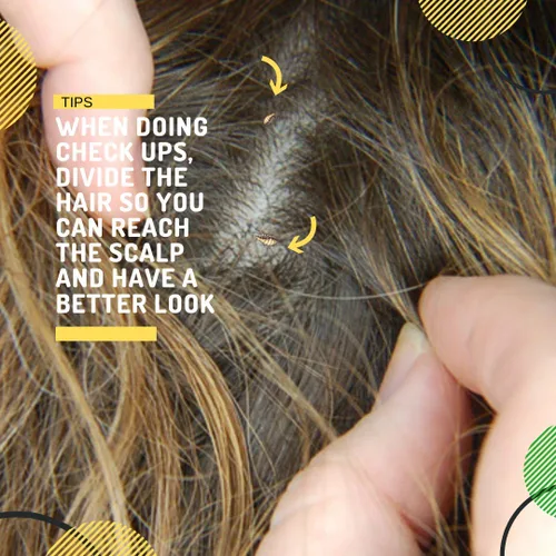 Vista 5 de Champú para piojos Ayuda a eliminar piojos, súper piojos y liendres Repele y previene Sin pesticidas 100% natural Árbol de té + aceite