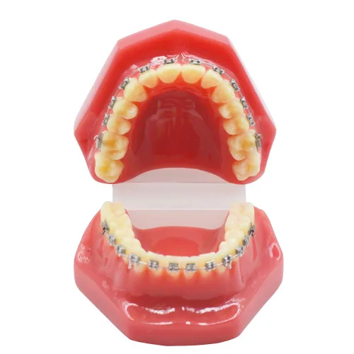 Vista 2 de Brcket dental del metal de ortodoncia con el modelo de los dientes de Typodont