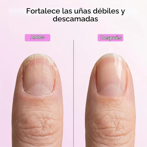 Vista 5 de Set de reparación de uñas Orly Nail Rescue