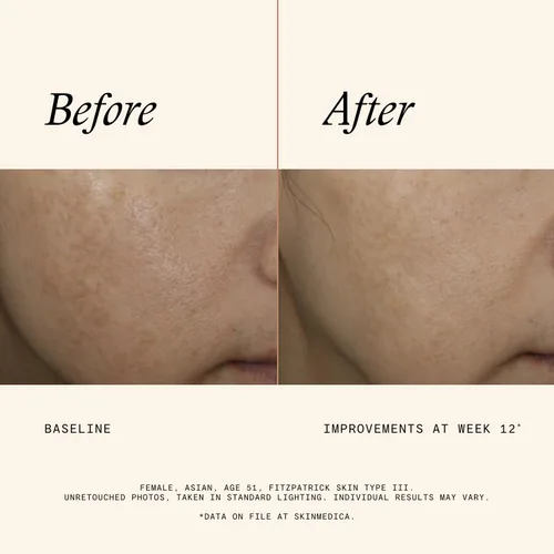 Vista 4 de SkinMedica Even & Correct Advanced Brightening Treatment Face Serum