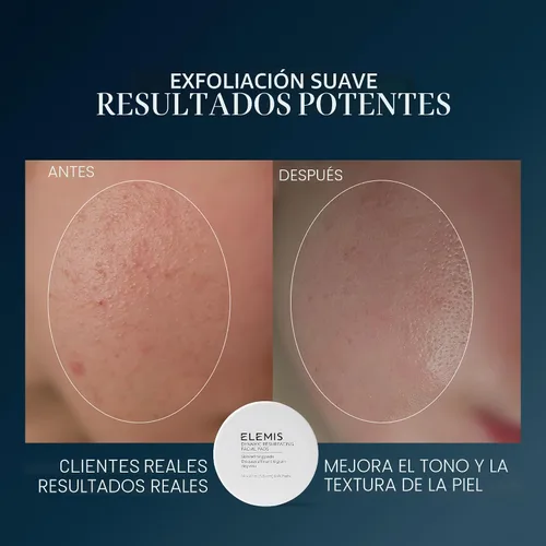 Vista 3 de ELEMIS Almohadillas Faciales de Renovación Dinámica, Almohadillas Faciales Exfoliantes de Tratamiento con Textura Suave
