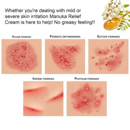 Vista 5 de Crema orgánica de loción de miel de manuka con avena coloidal, hidratante calmante para piel seca, para alivio, eccema de manos y cuerpo, psoriasis