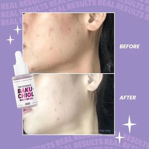 Vista 7 de Ahorra un 15 % en paquete facial de Bakuchiol - Aceite facial de Bakuchiol, exfoliante labial y mascarilla