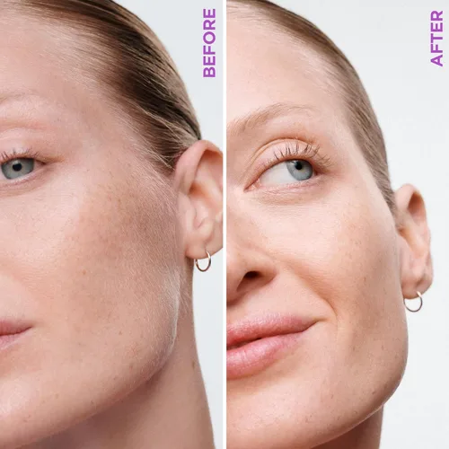 Vista 6 de Schick Hydro Silk Cuchillas de recambio de varita dermaplaning — Recargas, 6 estilo profesional