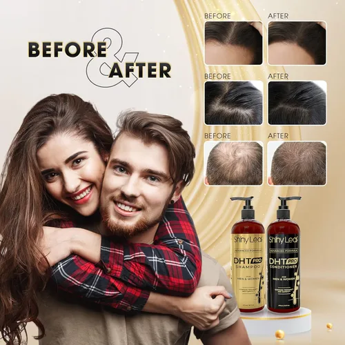 Vista 4 de Shiny Leaf DHT Pro Champú con Procapil y Capixyl para cabello adelgazante, 16 oz Advanced anti thinning shampoo with Procapil, Capixyl and DHT
