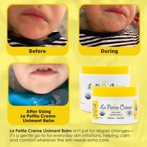 Vista 5 de La Petite Creme Bálsamo de pañales orgánico francés – Crema curativa y nutritiva para pañales – Bálsamo para bebés suave y seguro – Cera de abeja