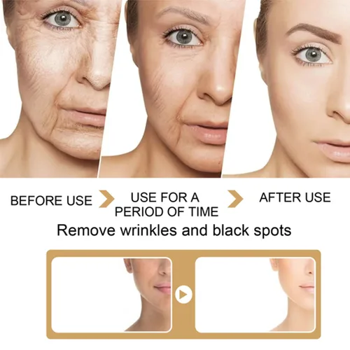 Vista 4 de Paquete de 2 sueros correctores de manchas oscuras con cúrcuma, suero facial reparador, cúrcuma natural para cuidado de piel brillante, sueros