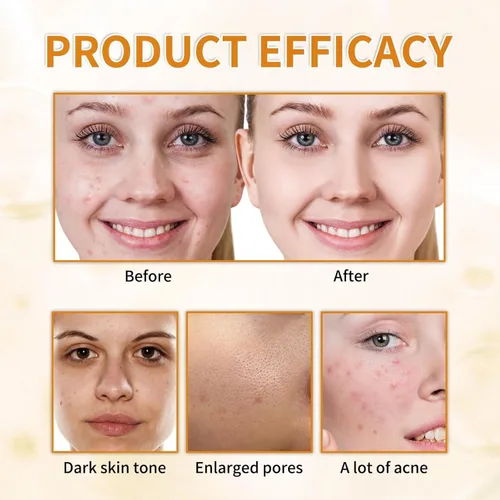 Vista 7 de Tónico exfoliante de ácido glicólico al 7%, tónico facial exfoliante, tóner minimizador de poros, piel suave, tono uniforme, fórmula hidratante
