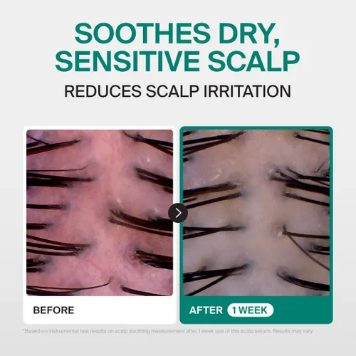 Vista 2 de Dr.FORHAIR Phyto Therapy Hydro Scalp Serum Roller 2.02 fl oz