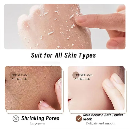 Vista 4 de Exfoliante De Arroz Para Aclarar La Piel, Exfoliante De Arroz Para Las Manchas, Exfoliante De Arroz Para Blanquear Gel Exfoliante, Exfoliante De