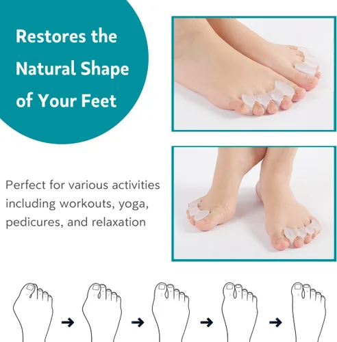 Vista 3 de 2 pares de separadores de dedos de los pies correctores de juanetes para mujeres/hombres, alineación de pies, esparcidores para juanetes, hallux