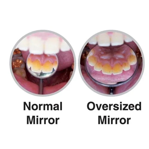 Vista 3 de Osung Espejo bucal de gran tamaño inclinable dental - DMS39