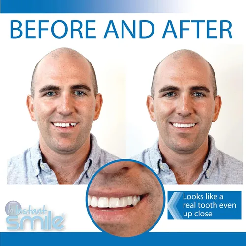 Vista 3 de Instant Smile Kit de dientes temporales -Pro-Series