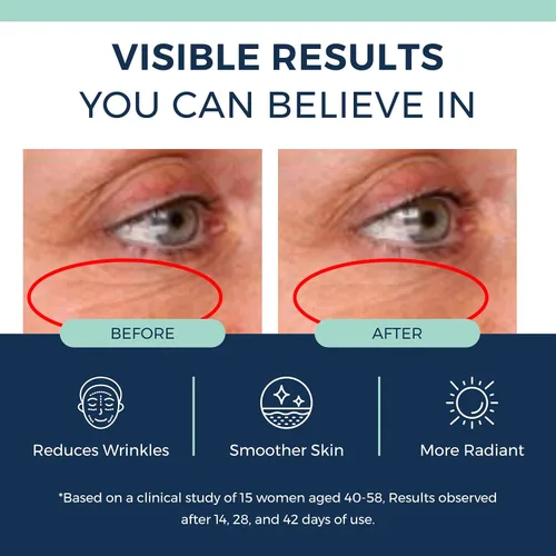 Vista 5 de Suero de colágeno con retinol antienvejecimiento para rostro: retinol encapsulado al 1%, niacinamida y ácido hialurónico, mejora las arrugas
