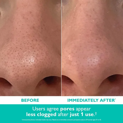 Vista 4 de Peter Thomas Roth Purificador exfoliante de poros con microdermoabrasión Even Smoother™ con ácido salicílico para el control del aceite