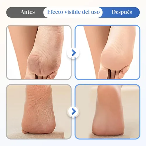 Vista 2 de Crema para Pies Hidratante y Anti-Grietas 60% Urea, 2025 Crema Hidratante Mejorada y Alivio para Grietas y Sequedad en Pies y Manos, Repara e