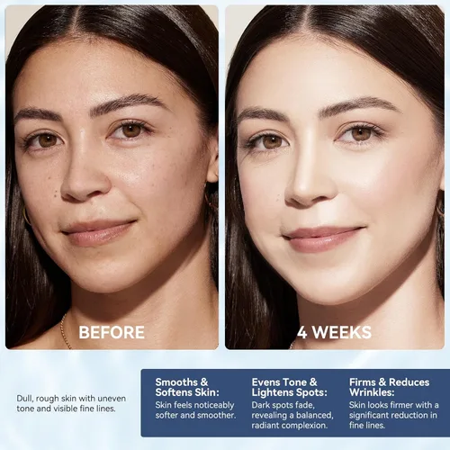 Vista 3 de Crema facial instantánea con retinol, colágeno y ácido hialurónico, crema de cuello para tensar y reafirmar – Hidratante facial antienvejecimiento