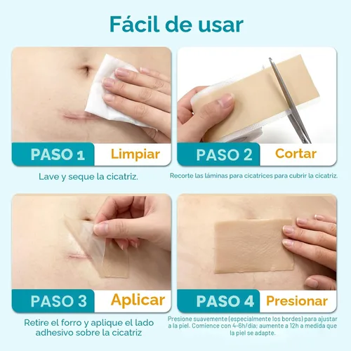 Vista 9 de Dimora UPF50+ - Hojas de silicona para cicatrices con protección UV, rollo de 1.6 x 78.7 pulgadas Protección UV, reutilizable, suaviza, aplana