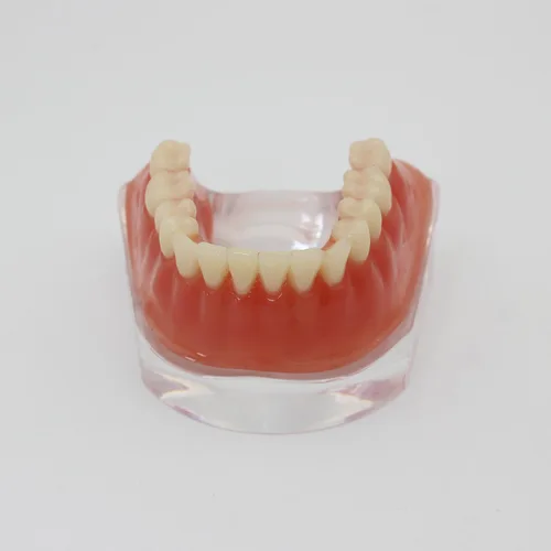 Vista 2 de Color dorado dental del diente inferior de la sobredentadura del implante de la precisión 4 modelo de los dientes