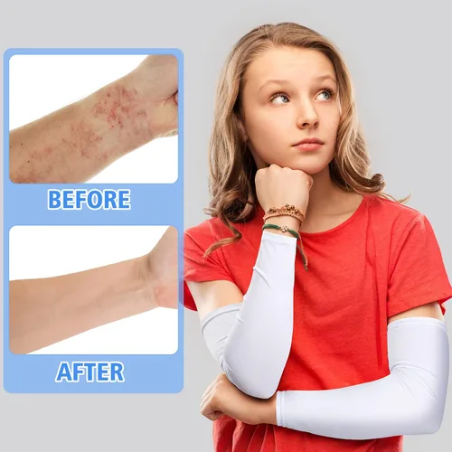 Vista 4 de Eurzom 8 pares de mangas para eccema para adultos, adolescentes, eczema, psoriasis, unisex, manga para piernas y brazos, para mujeres y hombres