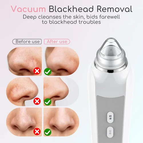 Vista 5 de Removedor de Puntos Negros al Vacío, Removedor de Cabezas Negras para la Cara con Cámara, Aspirador de Poros para Hombres y Mujeres, Herramientas