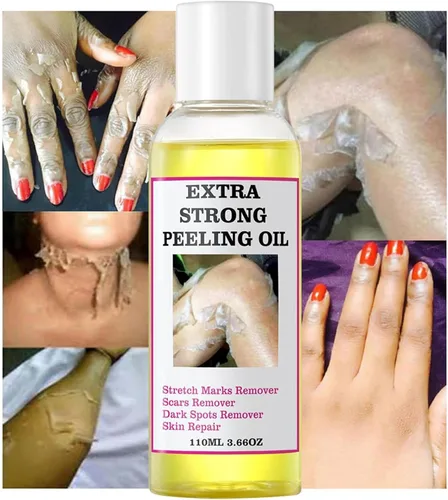 Vista 3 de Aceite de pelado amarillo, aceite de pelado fuerte para piel oscura, extra fuerte, solución exfoliante para el cuerpo, todo tipo de piel, removedor