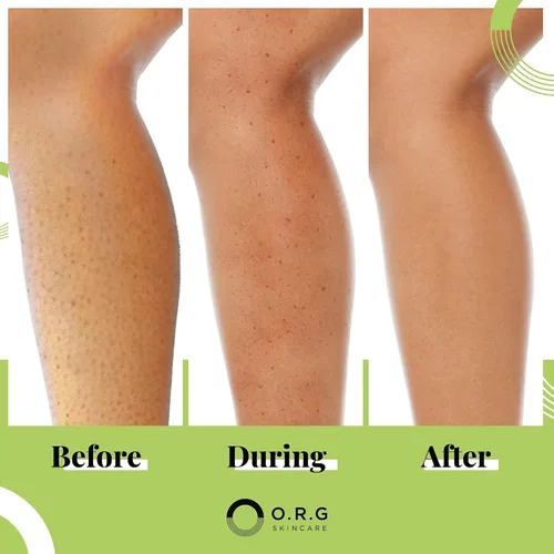 Vista 6 de Exfoliante corporal mineral O.R.G. (8 onzas)