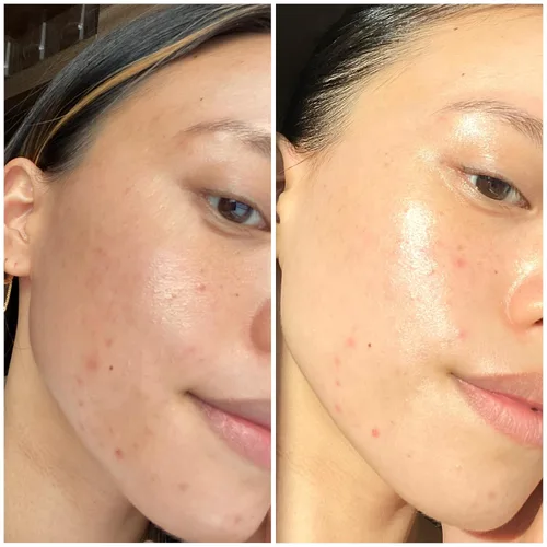 Vista 6 de Sand & Sky Mascarilla hidratante para el cuidado de la piel con ácido hialurónico - Máscara facial de hidratación intensa de agua de manantial
