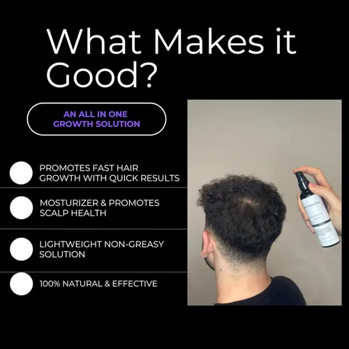 Vista 6 de Spray para el crecimiento del cabello para adelgazar el cabello, tratamiento de crecimiento del cabello para mujeres y hombres, fabricado en Estados