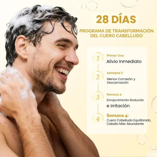 Vista 4 de Champú antifúngico mejorado para dermatitis seborreica, foliculitis y psoriasis del cuero cabelludo, champú anticaspa para hombres y mujeres, alivia