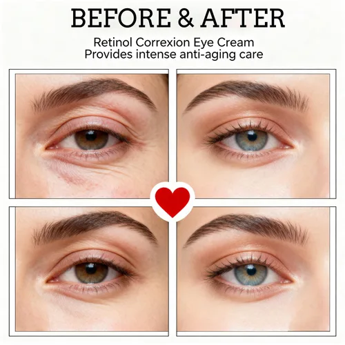 Vista 6 de Crema de ojos de retinol con niacinamida, ácido hialurónico y vitamina E – Suero hidratante debajo de los ojos para ojeras visibles, apariencia