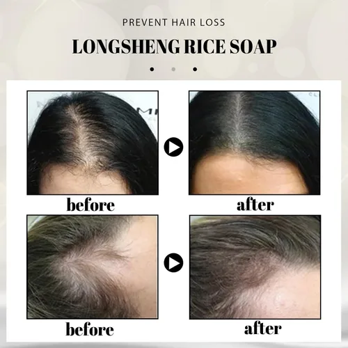 Vista 9 de Gegong Barra de champú, extracto de aloe vera de agua de arroz, ingredientes naturales, tratamiento de pérdida de cabello, control de aceite