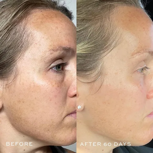 Vista 3 de DIME Beauty TBT Serum - Suero facial antienvejecimiento con bakuchiol, niacinamida y ácido mandélico, alternativa al retinol para líneas finas