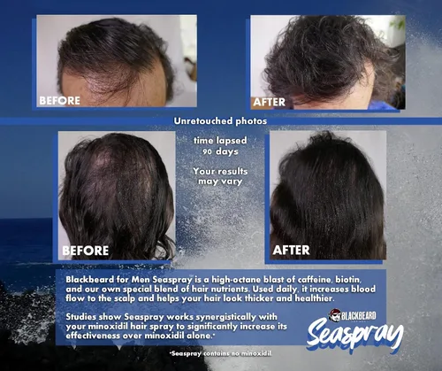 Vista 5 de Blackbeard Seaspray Hair Energizer - Suero en aerosol para hombre con biotina y cafeína, voluminizador para cabello más grueso y completo