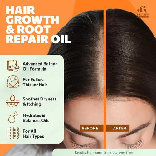 Vista 2 de Panda's Promise Aceite de batana puro de Honduras, mezcla vegana y prensada en frío con aceite hidratante para el cabello de romero y ricino para un