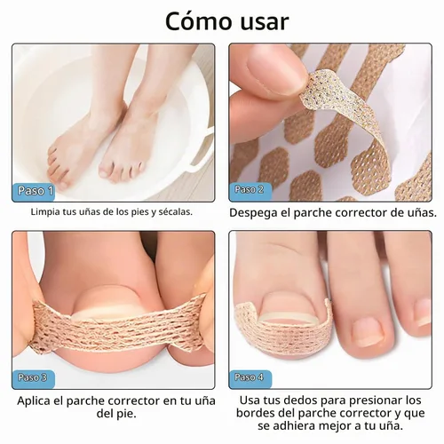 Vista 5 de Tratamiento de uñas encarnadas, 100 tiras transpirables de uñas encarnadas, herramienta de uñas encarnadas sin dolor, pedicura profesional