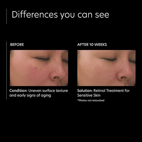 Vista 4 de PCA SKIN Tratamiento de retinol para pieles sensibles, suero facial antienvejecimiento para reducir suavemente el enrojecimiento y minimizar