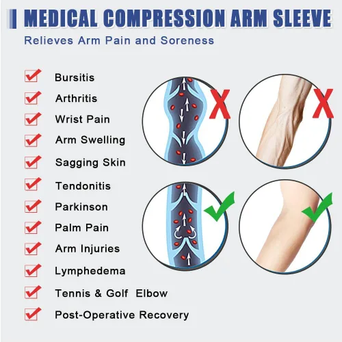 Vista 5 de beister Manga de compresión médica para hombres y mujeres (individual), soporte de brazo completo de 20-30 mmHg para aliviar el dolor, linfedema