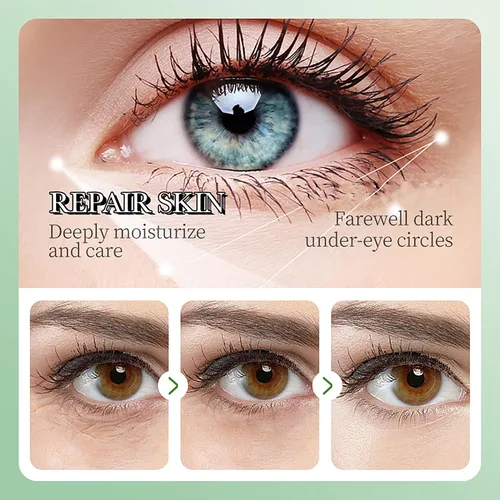 Vista 4 de AKARY Parches de aloe vera para ojeras, ojos hinchados y arrugas, 98% esencia de aloe y colágeno con infusión de colágeno, cuidado suavizante
