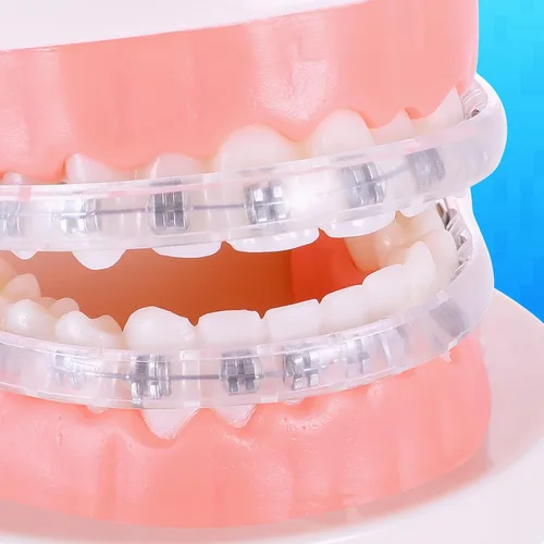Vista 5 de Fundas cómodas para aparatos ortopédicos, protector bucal de ortodoncia, protector de labios, alternativa a la cera, protector labial para soportes