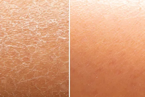 Vista 4 de Skin And Senses Brillo