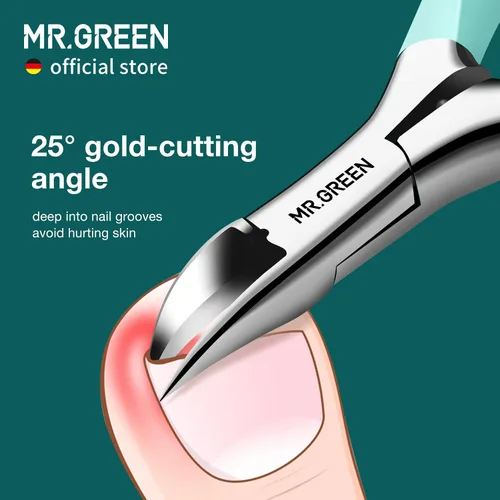 Vista 2 de MR.GREEN Cortaúñas de Acero Inoxidable para Uñas Encarnadas, Cortador de Uñas Gruesas y Duras, Herramientas para Manicura y Pedicura (Verde)