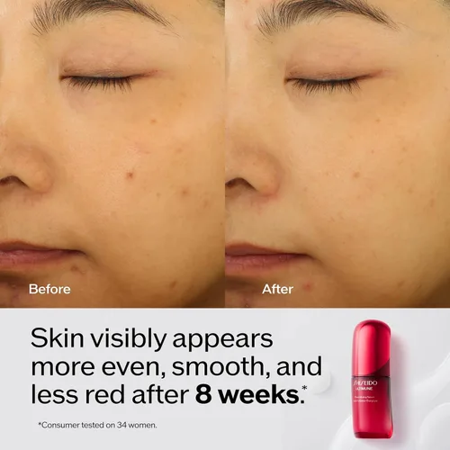 Vista 4 de Shiseido Ultimune Power Infusion Serum - Suero facial ligero innovador - Aumenta la luminosidad y mejora los signos visibles del envejecimiento