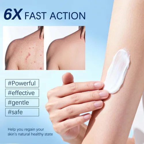 Vista 4 de Crema de foliculitis Alivia y ayuda a eliminar protuberancias en el cuero cabelludo, la cara, el cuerpo y los glúteos para pelos encarnados