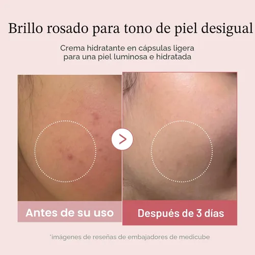 Vista 4 de medicube Dúo para Piel Desigual y Firmeza: Crema Hidratante Facial de Cápsulas Doradas de Vitamina C Profunda y Crema de Cápsulas de Colágeno Rosa