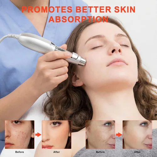Vista 6 de Elitzia ETF49E Dispositivo facial de electroporación sin aguja, máquina de belleza facial importadora de iones de mesoporación, eliminación