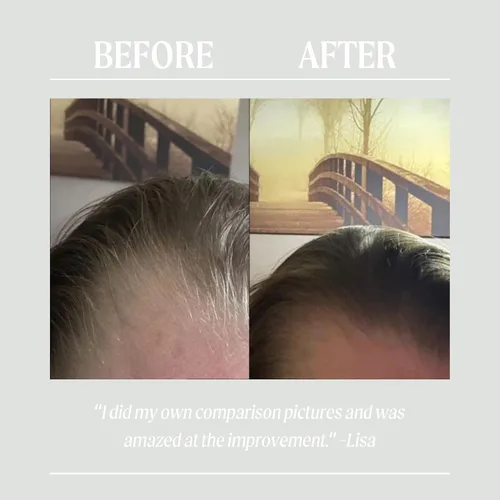 Vista 5 de UPCIRCLE Aceite para el cuero cabelludo + el cabello, 1.7 fl oz, se dirige a la sequedad + el daño, la mantequilla de bacuri restaura + reparaciones