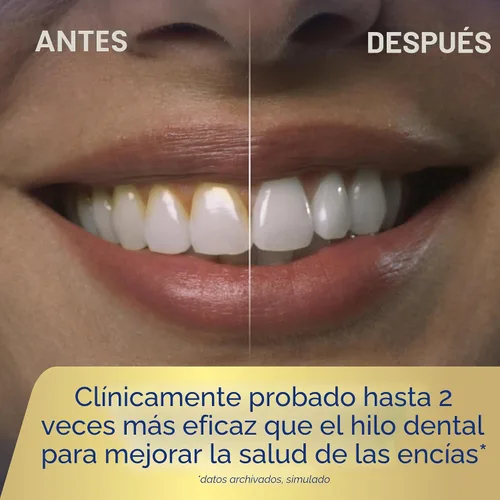 Vista 5 de Waterpik ION - Irrigador dental profesional, recargable y portátil para dientes, encías, aparatos ortopédicos, 10 ajustes, 7 puntas de irrigación