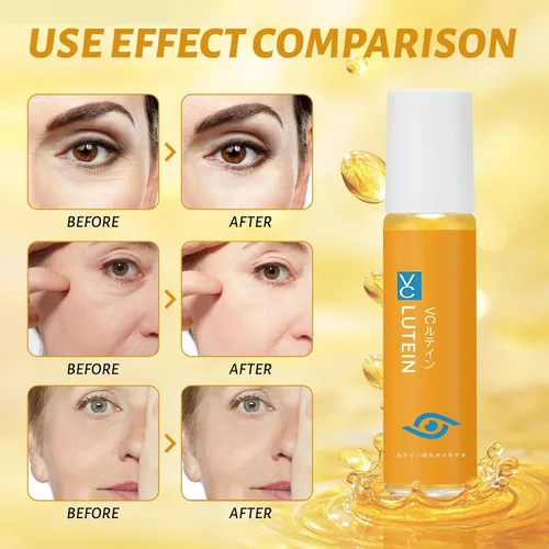 Vista 7 de 3 piezas de aceite de esencia de luteína para ojos, nueva actualización VC Luteína antiarrugas, aceite para ojos Ruy, bolsas para mejorar los ojos
