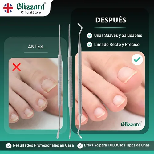 Vista 5 de Blizzard Juego de pedicura de lima negra de alta calidad, kit de 3 piezas de uñas encarnadas, limpiador de uñas de doble cara, lima de uñas